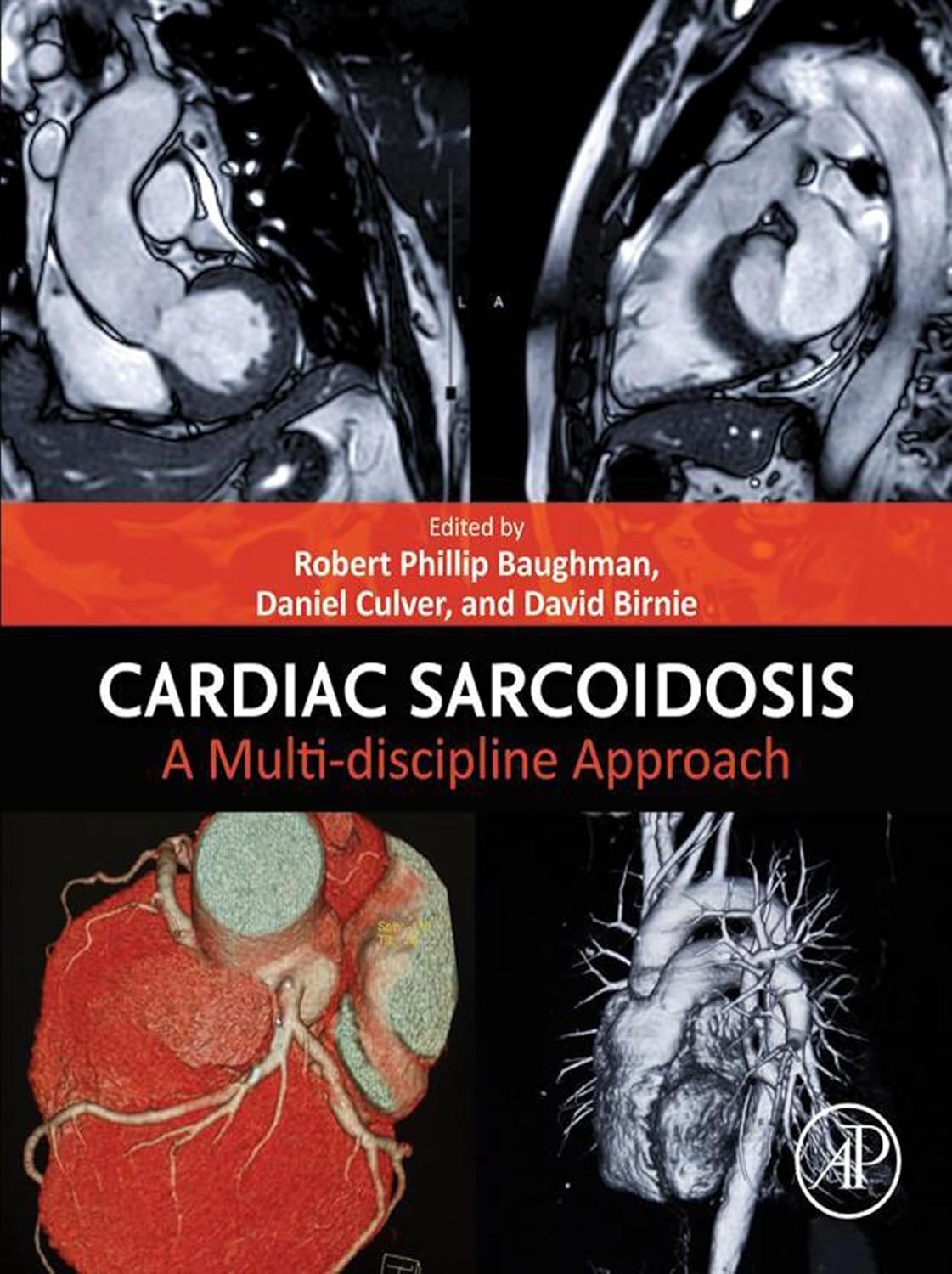 Cardiac Sarcoidosis: A Multi-discipline Approach